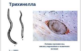 Трихинелла спиралис: жизненный цикл и особенности течения трихинеллеза