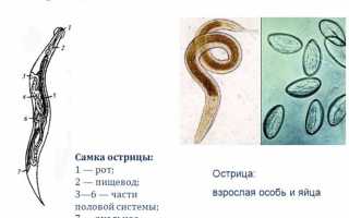 Острицы у детей: симптомы, лечение, профилактика