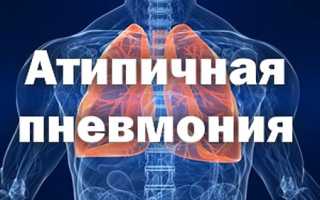 Атипичная пневмония — в чём отличие? Симптомы и лечение