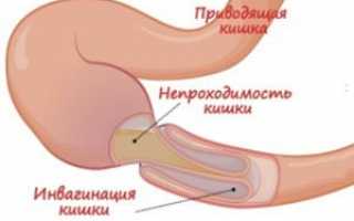 Пневматоз кишечника на УЗИ: что означает патология и как лечится?