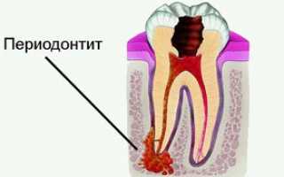 Когда, как и сколько чистить зубы для сохранения здоровья?