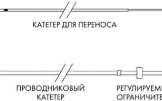 Болевые ощущения при ЭКО