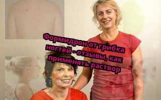 Формидрон от грибка ногтей, показания и способ применения