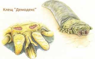 Демодекоз: что это за болезнь, причины развития, симптомы и лечение