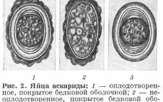 Яйца аскариды: как выглядят, где находятся в человеческом организме