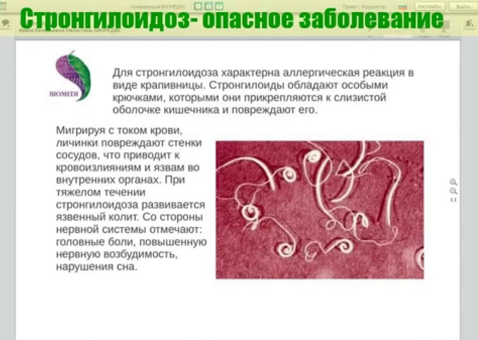 Особенности течения болезни