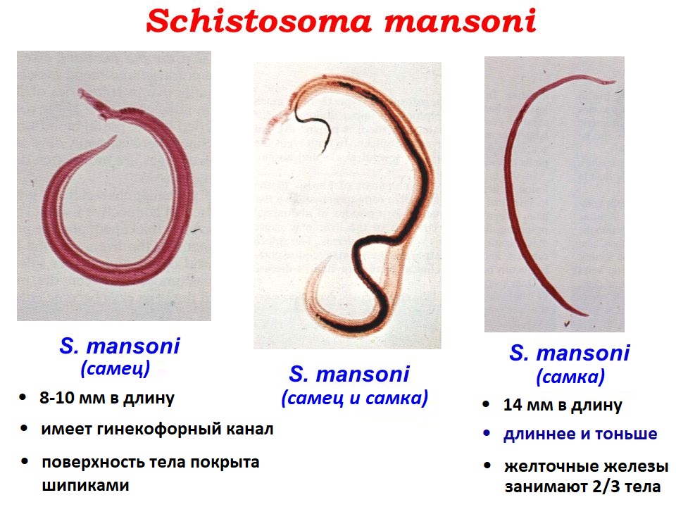 Шистосома Мэнсона
