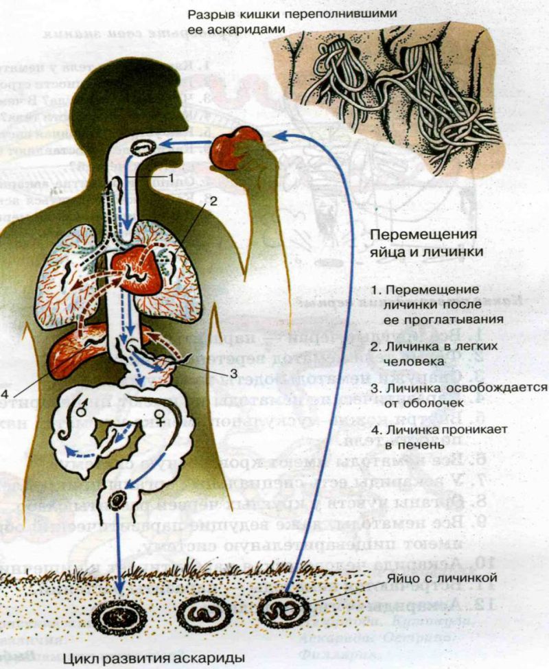 Локализация аскарид