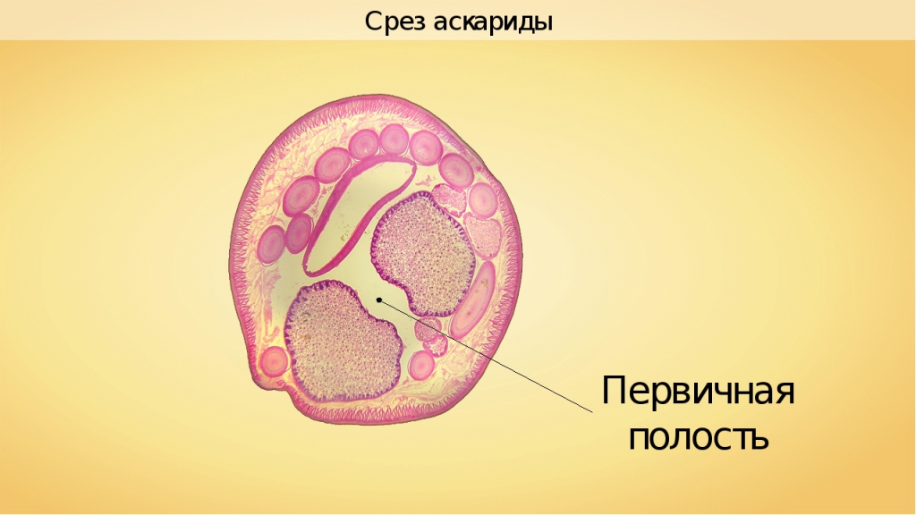аскарида