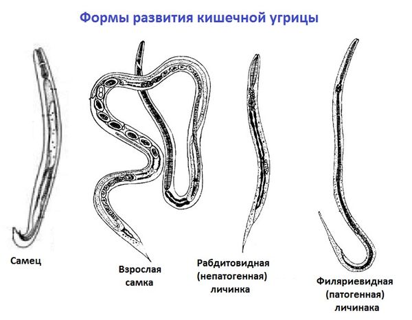 формы развития