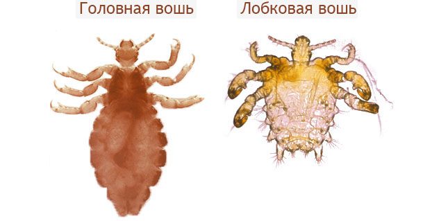 головная и лобковая вошь