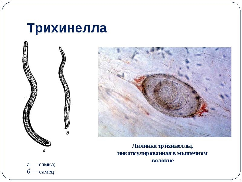 личинка трихинеллы