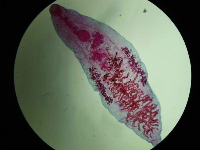 Opisthorchis felineus