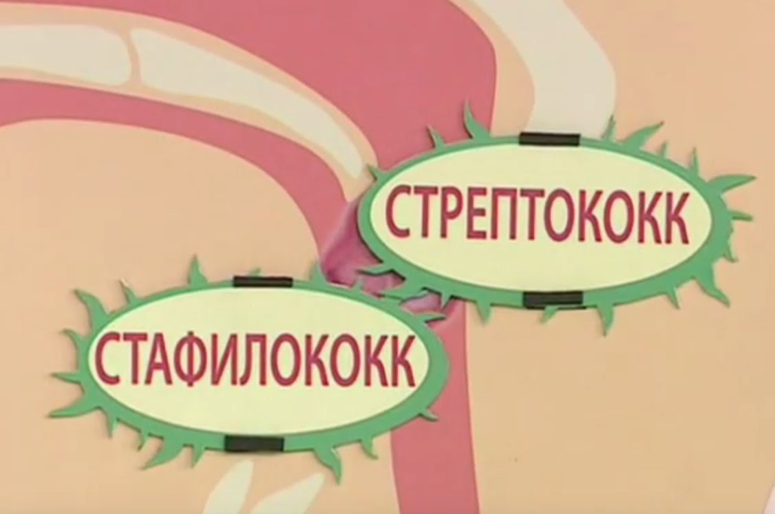 бактерии